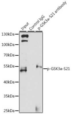 Immunoprecipitation: GSK-3 alpha/beta [p Ser21] Antibody - Azide and BSA Free [NBP3-05443]